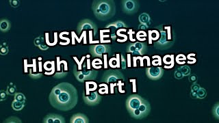 USMLE Step 1 High Yield Images Part 1 [upl. by Arrac]