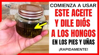 🔴✅ DILE ADIÓS A LOS HONGOS EN LAS UÑAS Y PIES CON UNAS GOTAS DE ACEITE DE ORÉGANO [upl. by Egduj25]