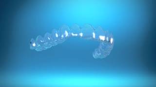 How do Invisalign aligners work [upl. by Asaeret]