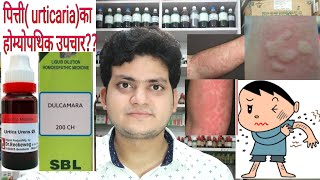 Urticaria Homeopathic medicine for Urticaria explain [upl. by Akitan400]