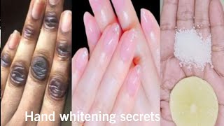 Permanent hand whitening secrets  Hand whitening secrets at home  Hand whitening secrets [upl. by Tremml95]