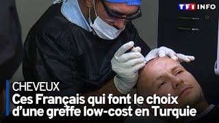 Enquête sur le marché des implants capillaires en Turquie [upl. by Crawley]