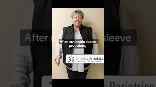 Weight Loss Journey Before amp After Photos of Bariatric Sleeve Surgery [upl. by Nie]