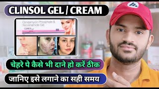 Clinsol gel how to use full review in hindi [upl. by Reuben]