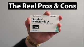 The Truth About Taking Finasteride  Pros And Cons Of Finasteride [upl. by Eduino]