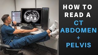 Radiology How to Read a CT Abdomen amp Pelvis My search pattern [upl. by Eimmak]