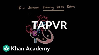 Total anomalous pulmonary venous return  Circulatory System and Disease  NCLEXRN  Khan Academy [upl. by Argella140]