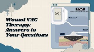 Wound VAC Therapy Your Questions Answered [upl. by Beatrix]