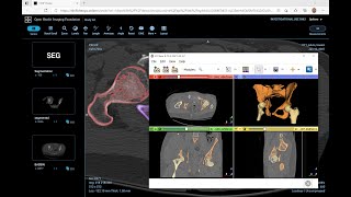 Using 3D Slicer with cloud DICOMweb databases [upl. by Josiah]