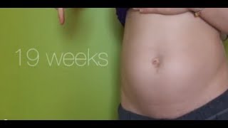 19 Weeks Pregnant  Food Troubles 7lbs Anatomy Scan BAD SKIN [upl. by Bloem786]