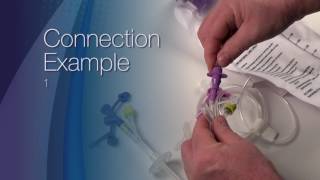 ENFit™ Transition Connector Demonstration [upl. by Htiaf]