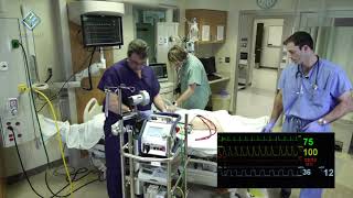 VA ECMO Arterial Air Emergency Cardiohelp  Innovative ECMO Concepts [upl. by Most654]