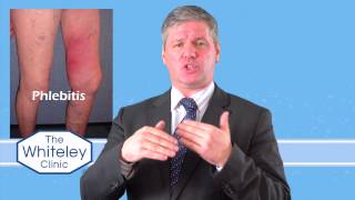 Phlebitis  What is phlebitis and how should phlebitis be treated [upl. by Vivl]