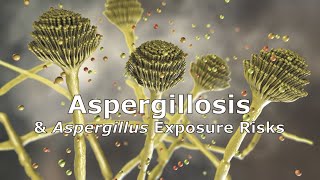 Aspergillosis and Aspergillus Exposure Risks [upl. by Berard]