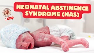 Neonatal Abstinence Syndrome NAS  wwwneonatologyforparentscom [upl. by Jary]