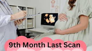 9th Month Pregnancy Ultrasound Last Scan Before Baby’s Arrival pregnancy pregnant dailyvlog [upl. by Aro309]