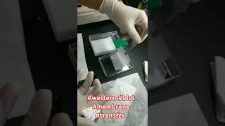 western blot membrane transfer [upl. by Neidhardt]