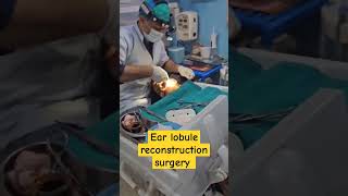 Ear lobule reconstruction surgery [upl. by Novikoff]