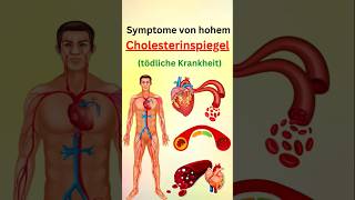 Symptome von hohem cholesterinspiegel [upl. by Marya]