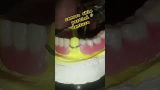 remove able partial denture by ali dental ceramic 😁😁😁artificialteeth completedenture dental [upl. by Hanako]