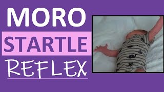 Moro Reflex Newborn Test  Startle Reflex  Pediatric Nursing Assessment [upl. by Ettenowtna256]