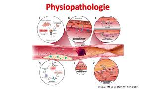 Syndrome des anticorps antiphospholipides  mise à jour  Pr P Fontana [upl. by Ueihtam954]