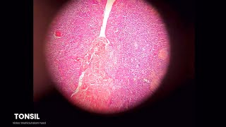 Lymphatic Systems Histology Slide Preview  Microscopic View  Anatomy [upl. by Susi]