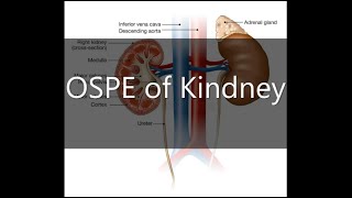 OSPE of Kidney  MBBS  2nd year  Anatomy  Spotting [upl. by Laehcimaj107]