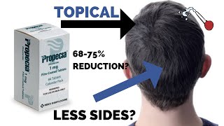 Topical Finasteride Science Pros and Cons and Practical Tips [upl. by Akaenahs]