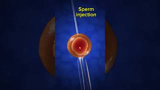 ICSIProcedure 3D Animation IVF ICSI Infertility FertilityTreatment September 24 2024 [upl. by Cartwell]