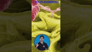 Diarrhea kyu hota he  Causes of acute diarrhea [upl. by Hamilton]