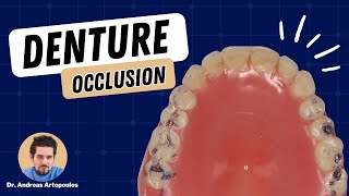 Occlusion for Complete Dentures  PDP162 [upl. by Lamoureux699]