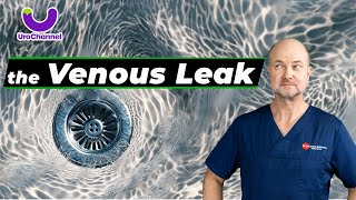 Young men are misdiagnosed all too often with the venous leak  UroChannel [upl. by Erodoeht]