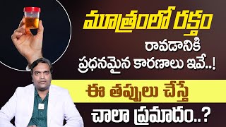 మూత్రంలో రక్తం  Symptoms and Causes of Blood in Urine Telugu  dr Ravi Teja  MhathiHealth [upl. by Gilmour79]