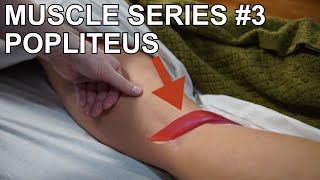 Say Goodbye to Knee Pain Popliteus Treatment [upl. by Livia]