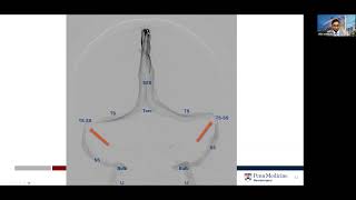 Venous Manometry Explained [upl. by Yelsnit]