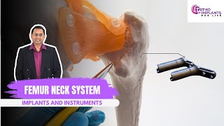 Femur Neck System  FNS  Implants and Instruments [upl. by Leihcim578]