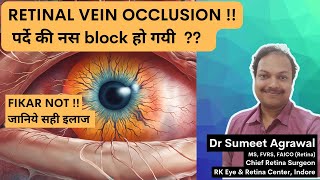 पर्दे की नस block हो जाए Retinal Vein Occlusion तो क्या करें [upl. by Eetnod663]