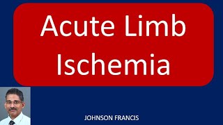 Acute Limb Ischemia [upl. by Reider157]