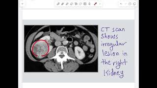 Urological Investigations  P2  urology [upl. by Norrehc]