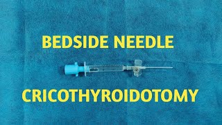 Emergency Needle Cricothyroidotomy [upl. by Nahgam699]