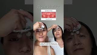 how to use red LED and gua sha to target 11 lines on the forehead [upl. by Raviv]