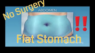 How I got a Flat Stomach in a week with cool sculpting  NO SURGERY [upl. by Tutto874]