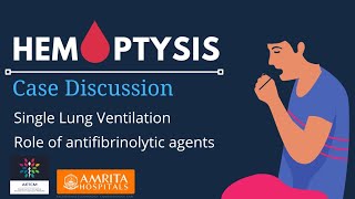 Hemoptysis  Case Discussion [upl. by Yecrad]