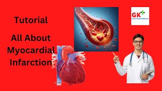 Myocardial Infarction Etiology Pathophysiology Symptom and Treatment [upl. by Yadrahc]