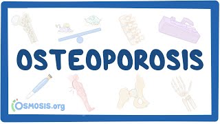 Osteoporosis  causes symptoms diagnosis treatment pathology [upl. by Faustine]