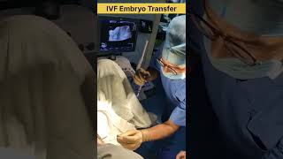 How embryo transfer is performed in IVF drrakshitamalik ivfspecialist ivfsuccess ivfjourney ivf [upl. by Blandina]