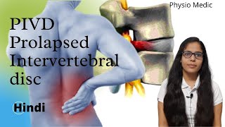 Introduction  Prolapsed Intervertebral DiscPIVD  Made Easy  Hindi  Part 1 Back Pain [upl. by Eecrad544]