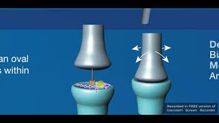 Condyloid amp Ellipsoid synovial joints [upl. by Araem]