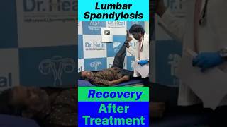 Lumbar Spondylosis Recovery After Treatment ad viralvideo motivation yt youtubeshorts fyp [upl. by Aitercal]